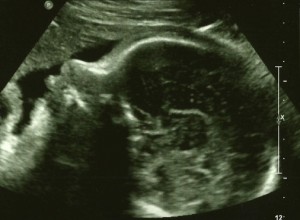 ultrasound face profile